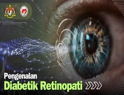 Pengenalan Diabetik Retinopati